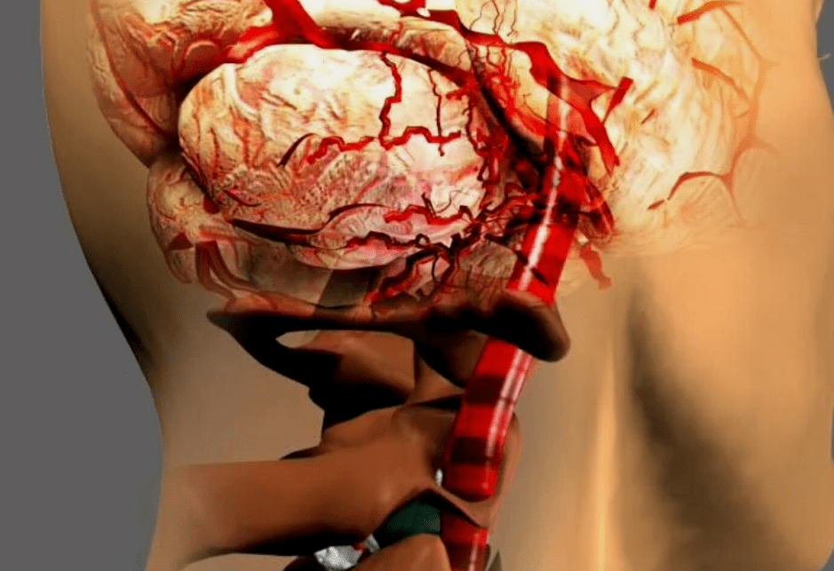 L'osteocondosi cervicale è pericolosa