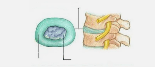 Natura dell'osteocondrosi