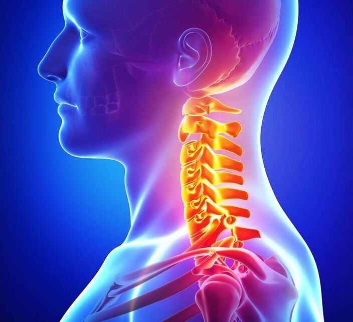 Osteocondrosi del rachide cervicale